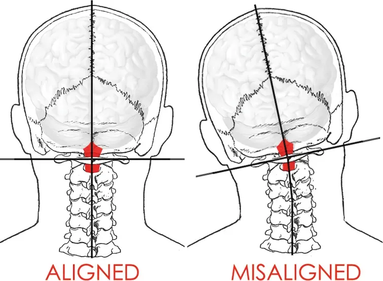 Aligned Misaligned 2