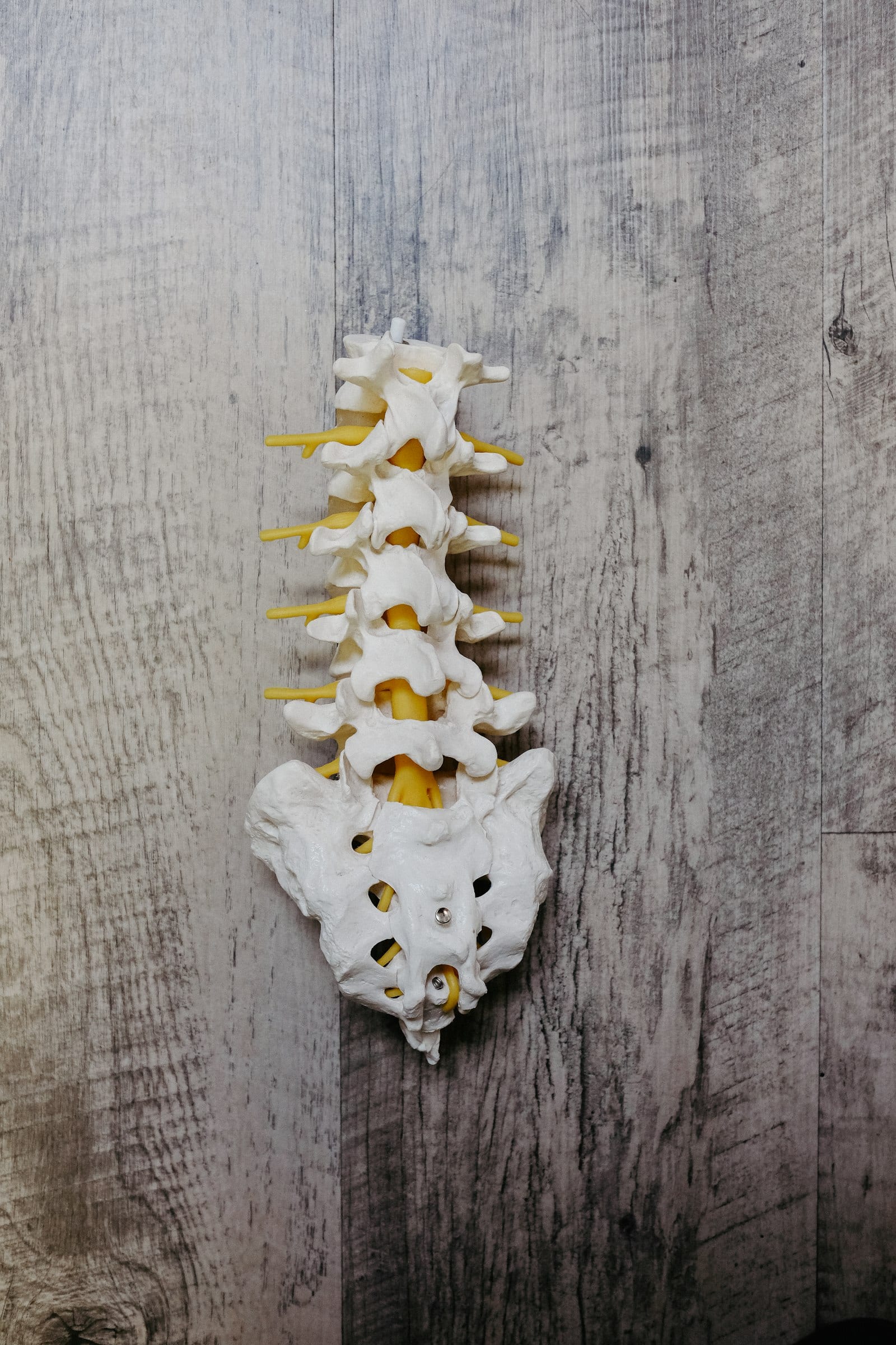 Person with sciatica-related back discomfort