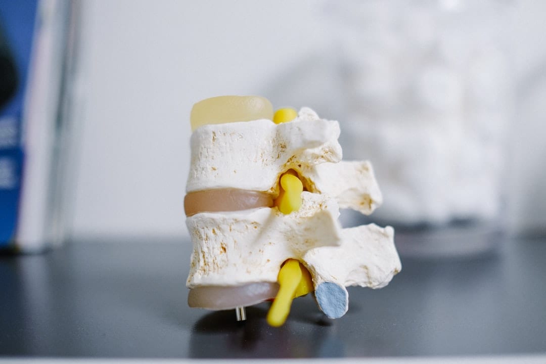 Detailed anatomical spine model on a clinical surface, illustrating the vertebral structures relevant to understanding sciatica and upper cervical care