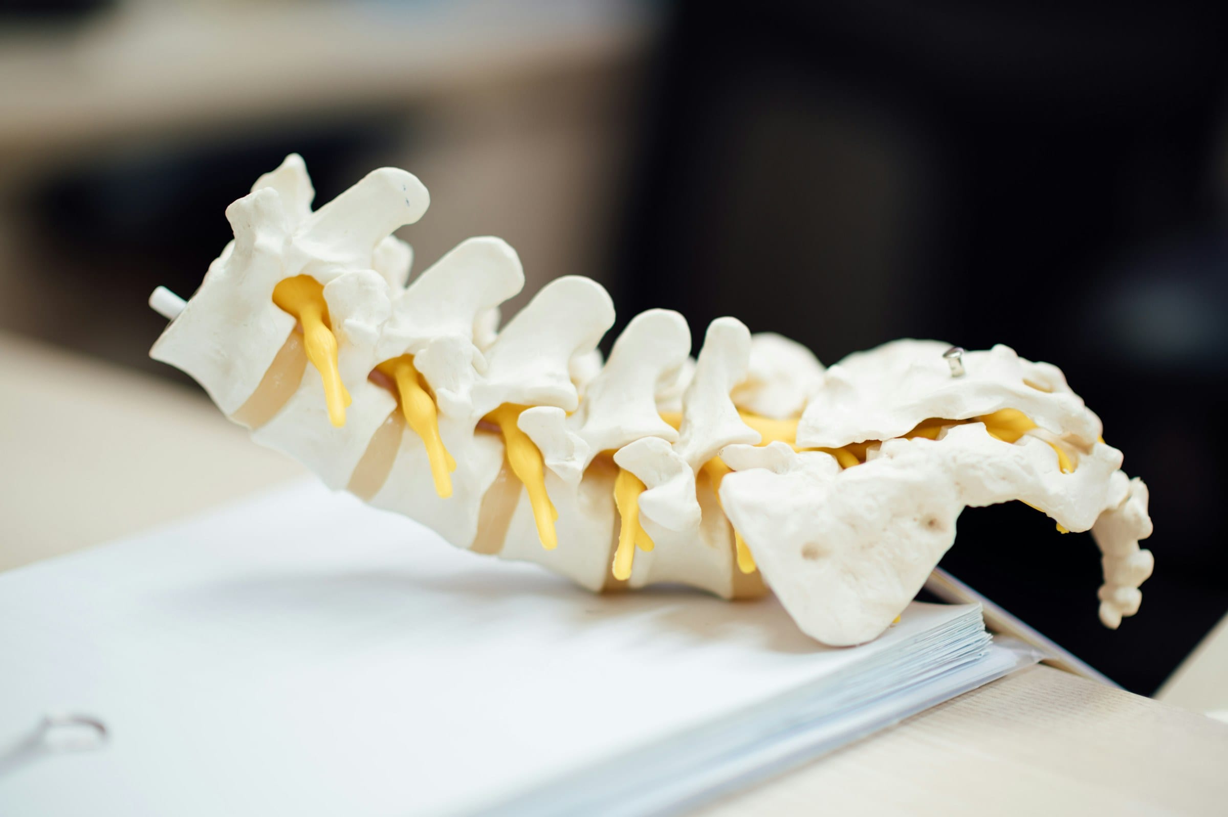 A cervical spine model illustrating the upper-cervical structures involved in whiplash recovery and precision alignment care.